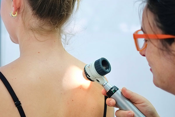 Skin Cancer Checks